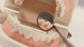 Неправильный прикус зубов: что надо знать